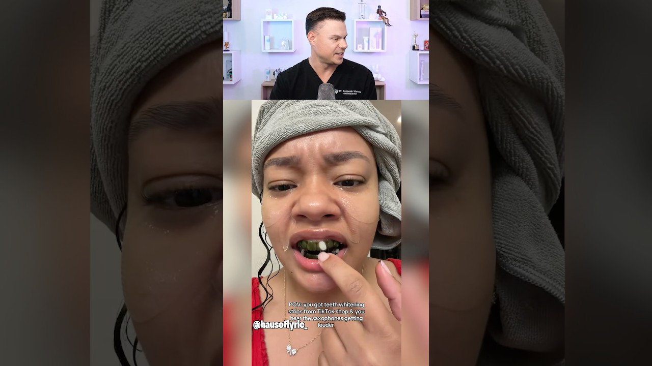 Are These Teeth Whitening Strips Another  SCAM?! 😳🦷