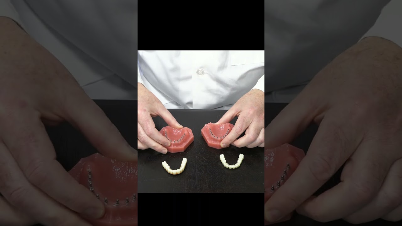 What is a Roundhouse? | Wilkes-Barre | Mint Mini Dental Implants #shorts