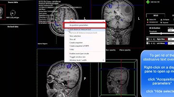 nordicBrainEx v2.1 How to perform fmri analysis