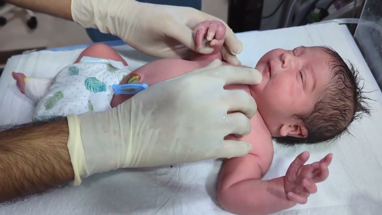 baby nasal suction and oral suction procedure| newborn baby | adorable baby nasal suction