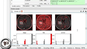 MRI Brain Tumor Detection and Classification Using KNN In PYTHON - Digital Image Processing