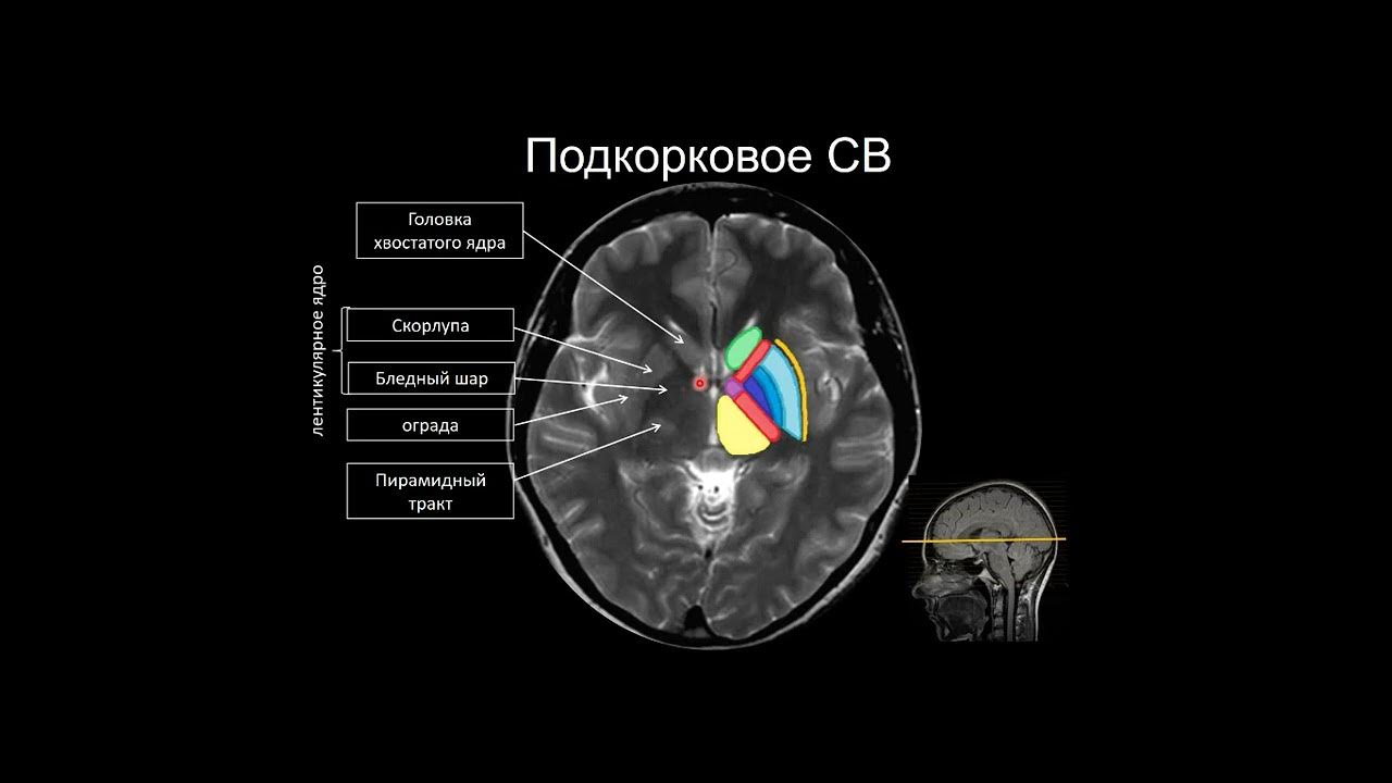 Область ядра мозга