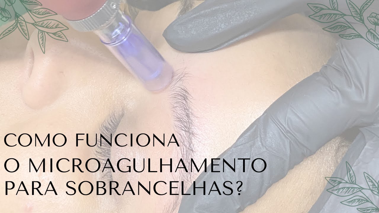 Como funciona o MICROAGULHAMENTO PARA SOBRANCELHAS