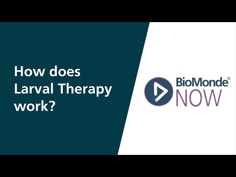 How does Larval Therapy work? | Your Questions Answered