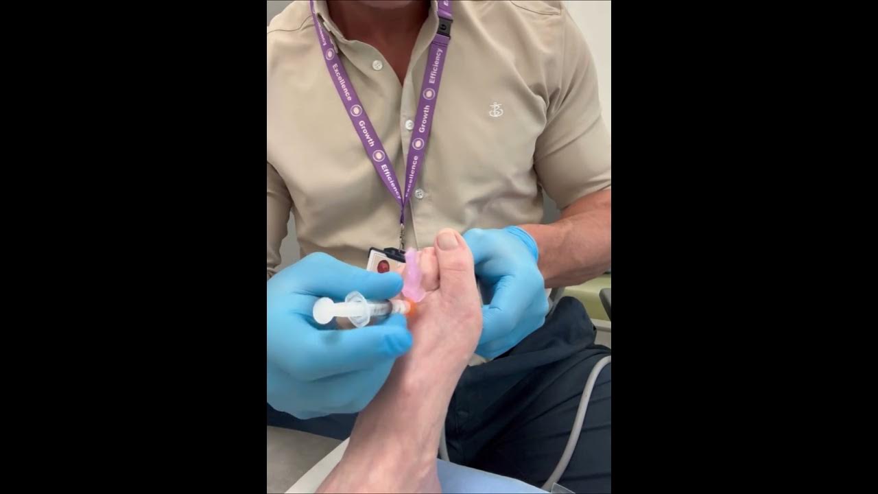 What Can I Take For Foot Nerve Pain