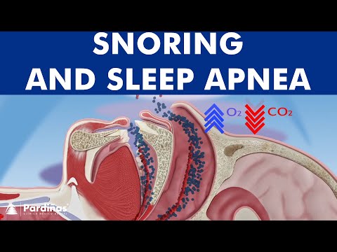 Snoring and sleep apnea - How to treat it ©