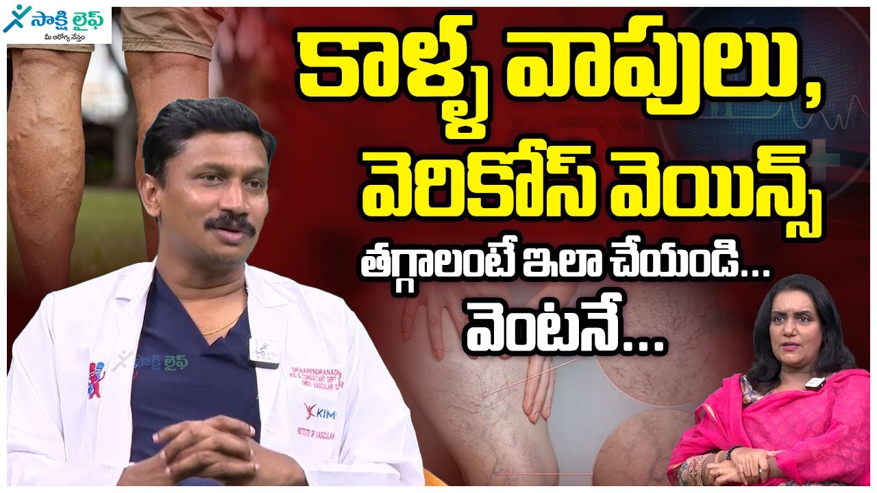 10 Best Home Remedies for Varicose Veins | Varicose Veins | Dr. Narendranath Meda | Sakshi Life