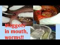 Maggots in mouth poor oral hygiene and tabacco chewing a case of odisha