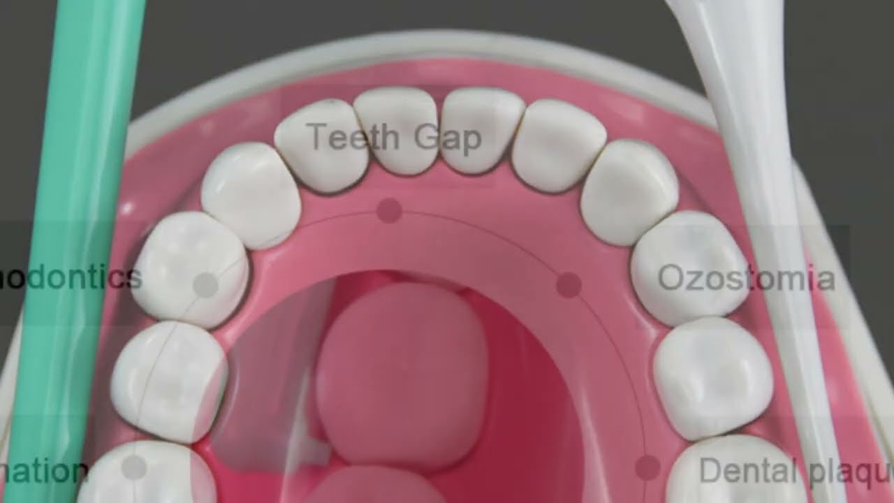 Portable Oral Irrigator & Water Flosser: Fresh Breath Made Easy!