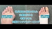 外反母趾を緩和する4つのストレッチ 4 Stretches For Bunion Youtube 外反母趾を緩和する4つのストレッチ 4 Stretches For Bunion Youtube