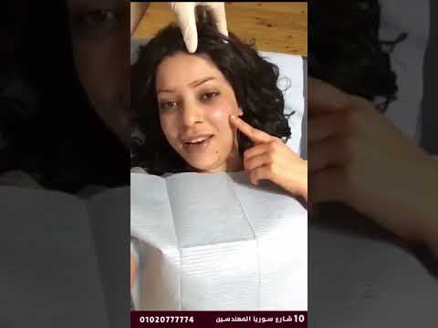 حقن الخدود وتجديد الكولاجين في الوجه في مركز هارموني كلينك 