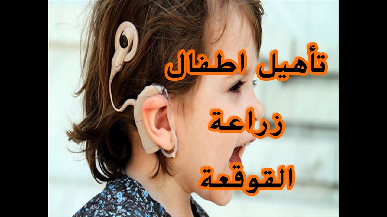 تأهيل اطفال زراعة القوقعة والضعف السمعي في المنزل