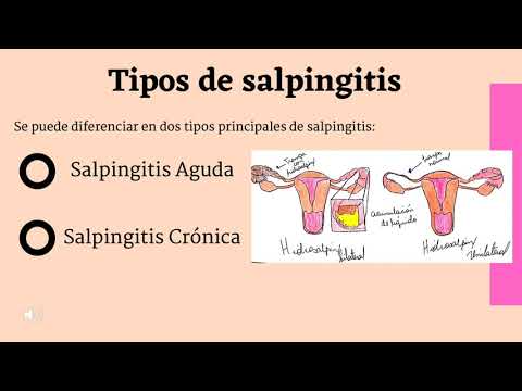 Vídeo: Salpingitis: Salpingitis Crónica, Síntomas Y Tratamiento