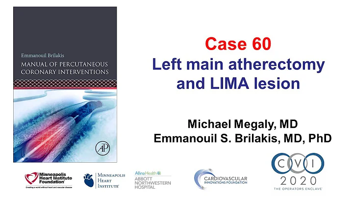 Case 60: PCI Manual - Left main and LIMA PCI in a prior CABG patient
