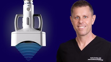 Cancer Treatment Breakthrough: How Histotripsy Transforms Tumor Removal