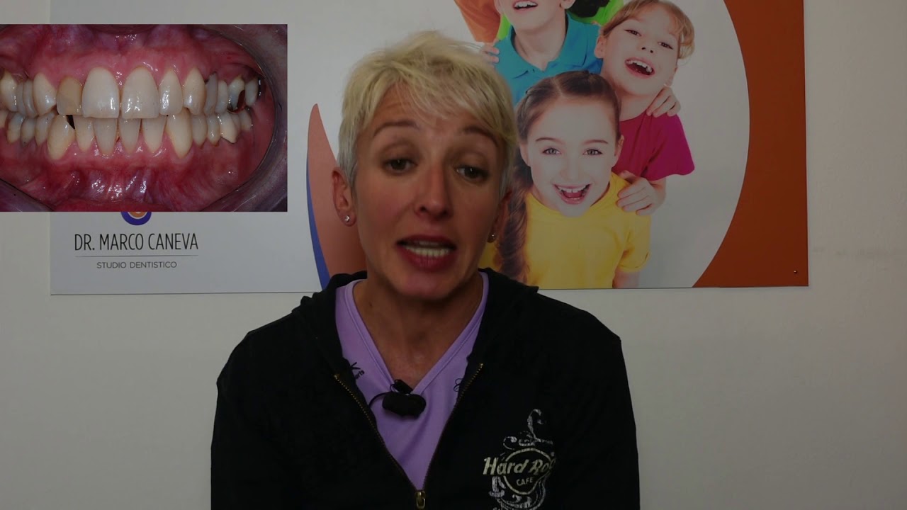 Video testimonianza di Daniela