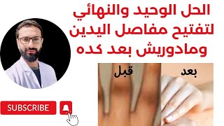 كل الحلول الممكنة لتفتيح مفاصل اليدين مدورش في مكان تاني علي حل