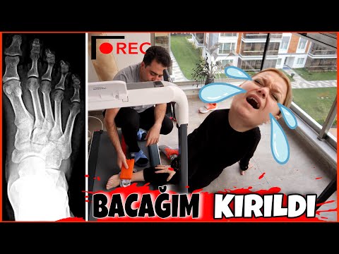 BACAĞIM KIRILDI ŞAKASI !! Cihan Çok korktu 😱