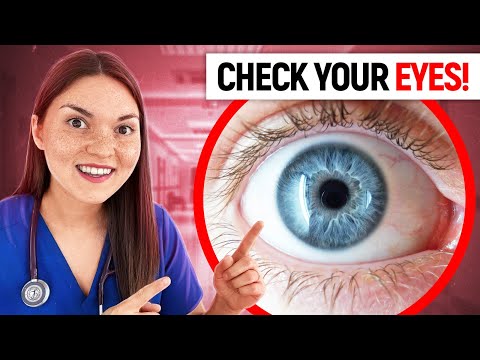 Video: Vai dabiskajām acīm ir limbāls gredzens?
