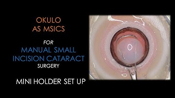 BIONIKO OKULO MSICS - Manual Small Incision Cataract Surgery