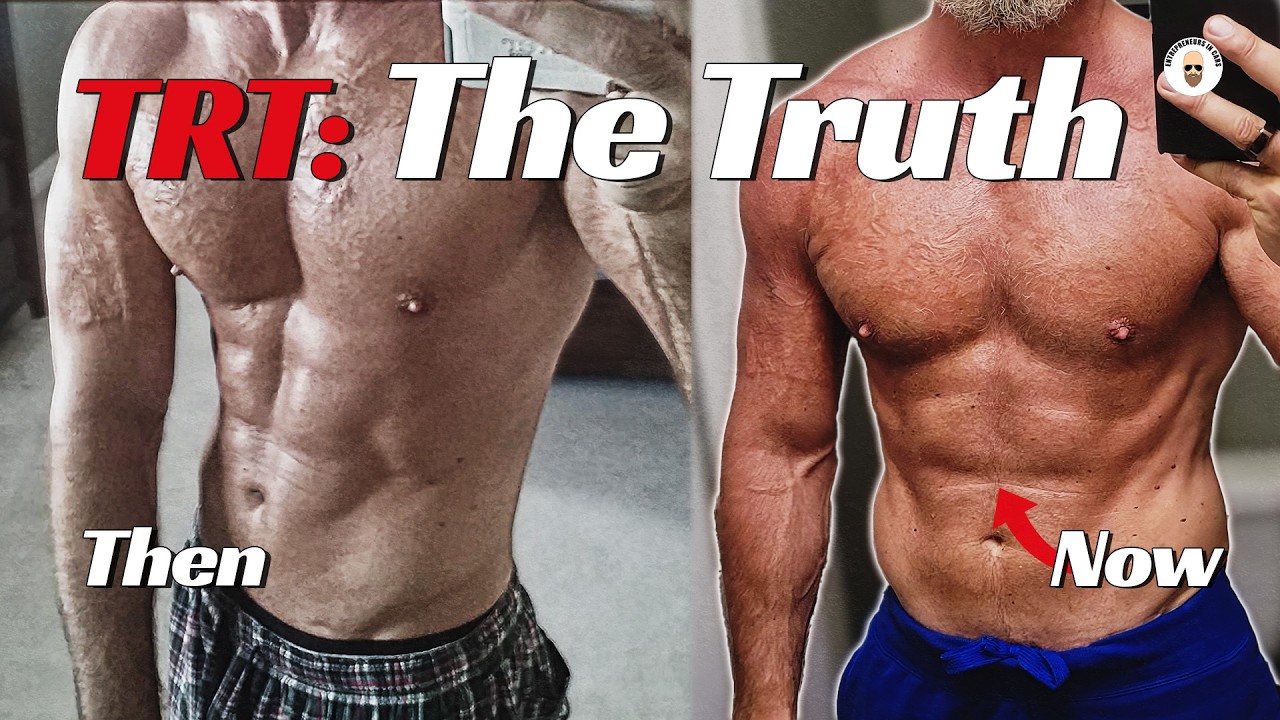 Outline Video TRT: The UGLY Truth They Didn't Tell Me About Testosterone Replacement Therapy