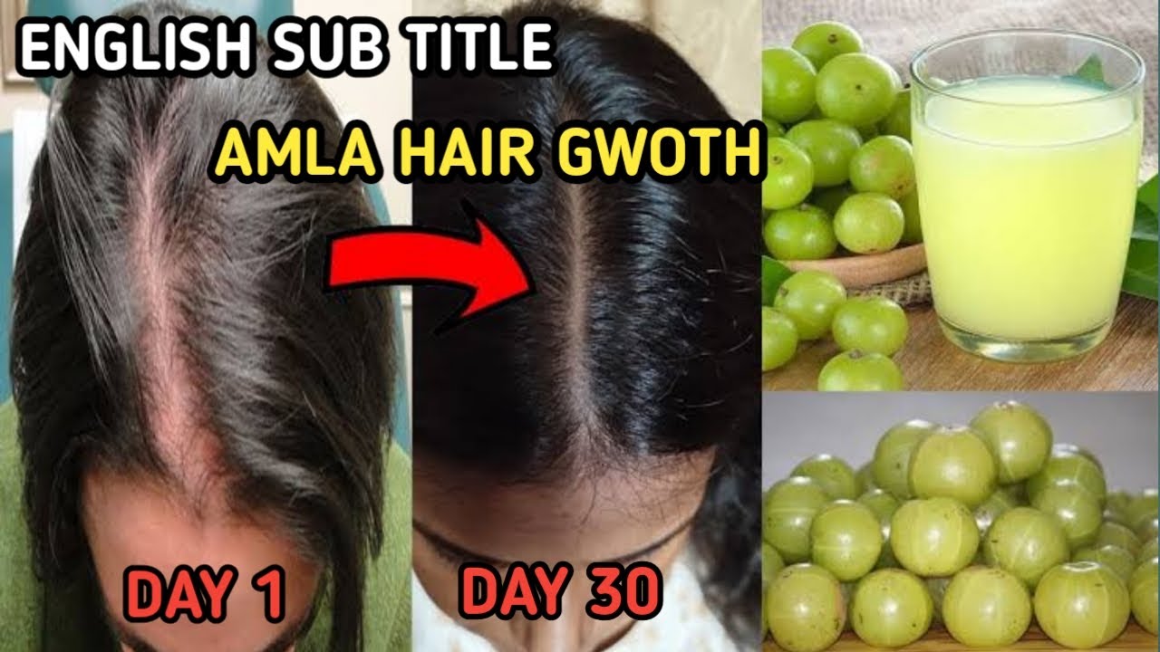 Amla juice Hair Oil for Double Hair Growth - Get Long Hair & turn thin ...