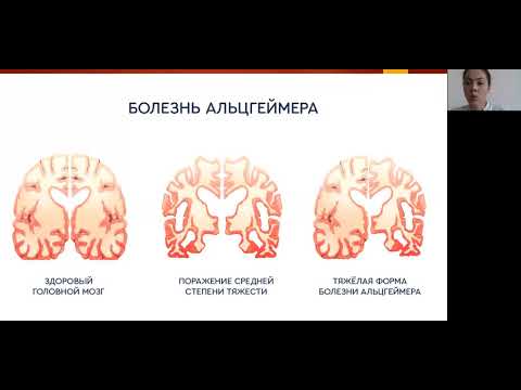 Жүйке жүйесінің патологиясы Акбаева А.Т