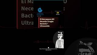 ⚕️ El Marcapasos NO Necesita Cirugía: Bacteria + Ultrasonido #Shorts