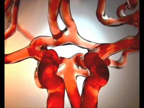 embolia paradossa British Heart Foundation - Emboli, small but deadly