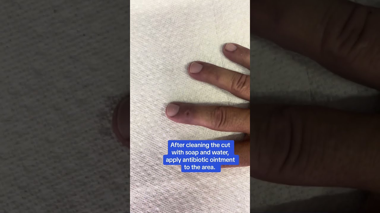 Do Wounds Need Air To Heal 