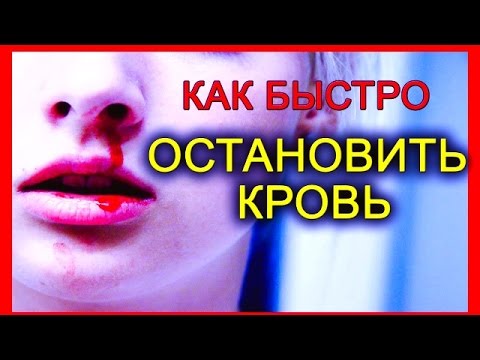 КАК ОСТАНОВИТЬ КРОВЬ ИЗ НОСА БЫСТРО (7 СПОСОБОВ)