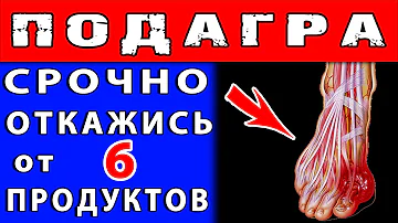 ЗАПРЕЩЕННЫЕ ПРОДУКТЫ при ПОДАГРЕ 👍 Это НАДО ЗНАТЬ !