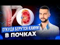 Откуда берутся камни в почках | Причины мочекаменной болезни