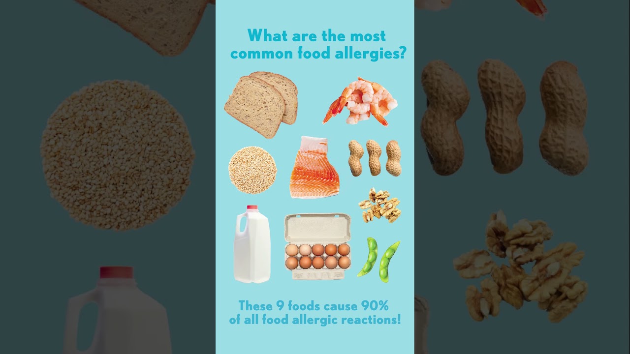 What are the Most Common Food Allergies? | #shorts