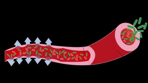 Sepsis 2021 Recommendation_Brief Overview_Dr Pradeep Rangappa
