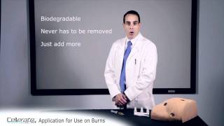 CellerateRX Activated Collagen Use on Burns
