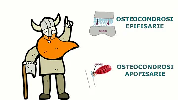 Come si cura il morbo di Perthes?