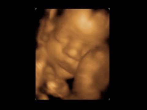 Belly Update!