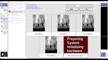 Training: Apteryx XVWeb: Capturing a Continuous Endo Series in XVCapture