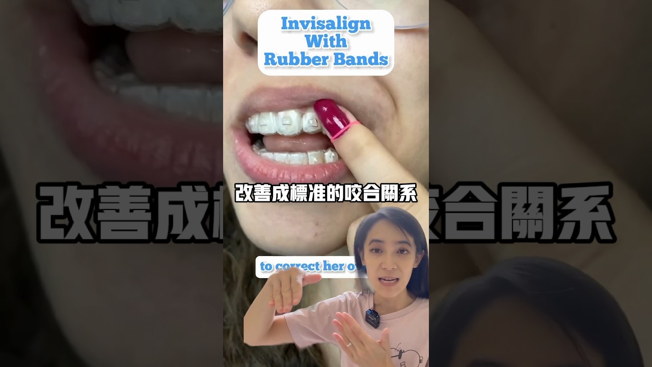 爲什麼隱適美會失敗?