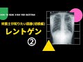 #47の②【栄養士が知りたい画像(初級編)_レントゲン】How to Read  X-ray for Dietitian