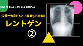 #47の②【栄養士が知りたい画像(初級編)_レントゲン】How to Read  X-ray for Dietitian