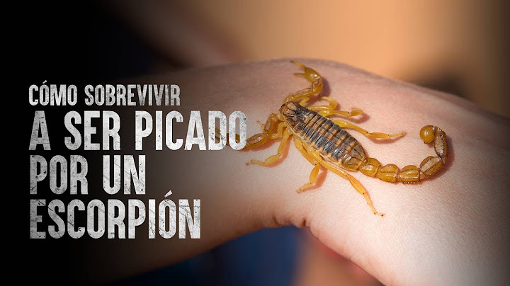 Cómo sobrevivir a la picadura de un escorpión
