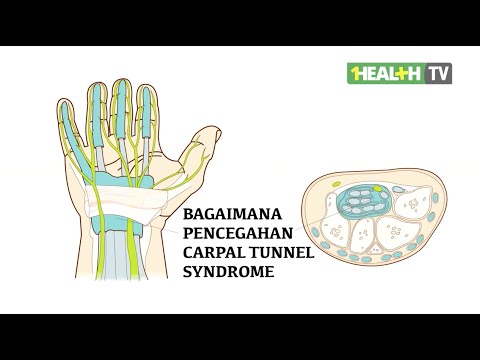 Bagaimana Pencegahan Carpal Tunnel Syndrome - dr.Ferry Senjaya,SpBS