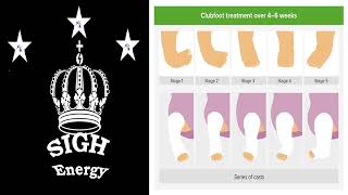 Clubfoot EXTREMELY POWERFUL!!! (Energetically Programmed) Wealth