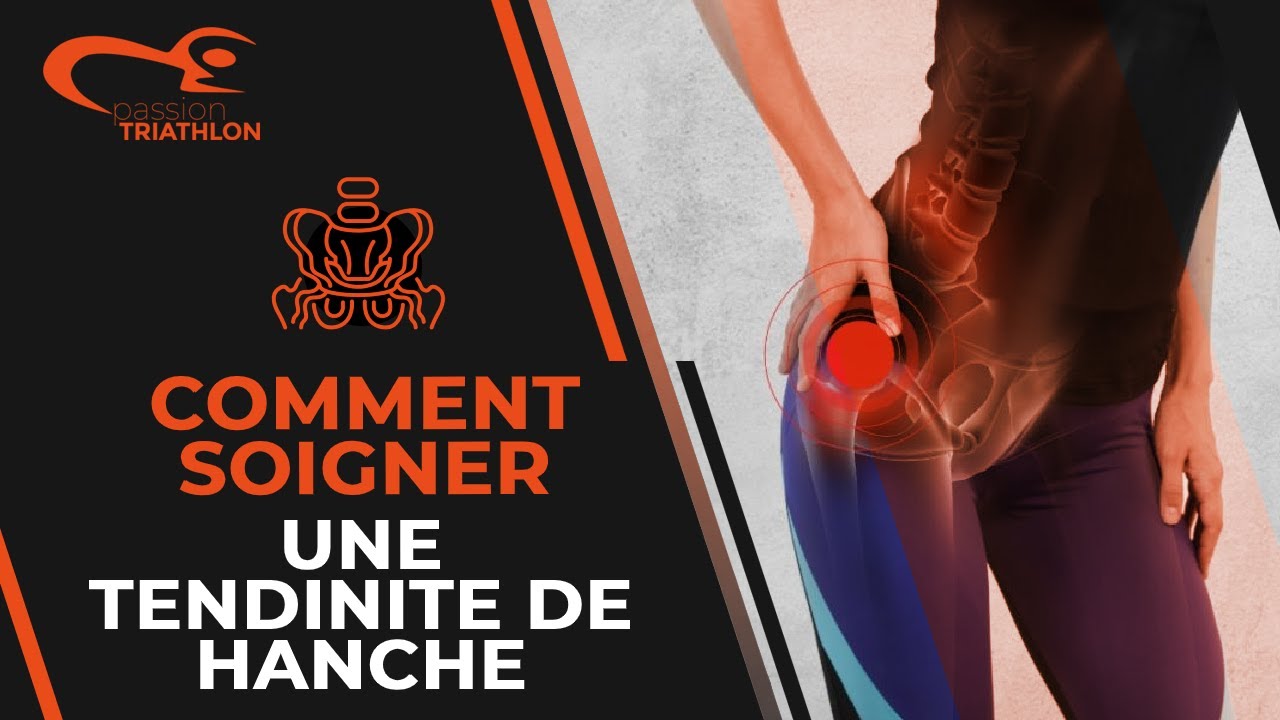 tendinite hanche : Comment la traiter rapidement ?