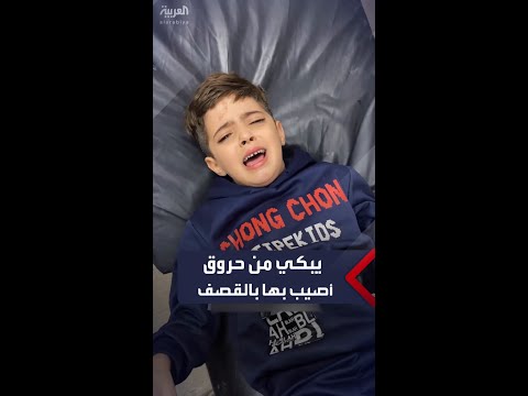 طفل من غزة يبكي من ألم الحروق التي أصابت قدميه بالقصف