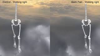 Walking task (right). Front View. Side by side.