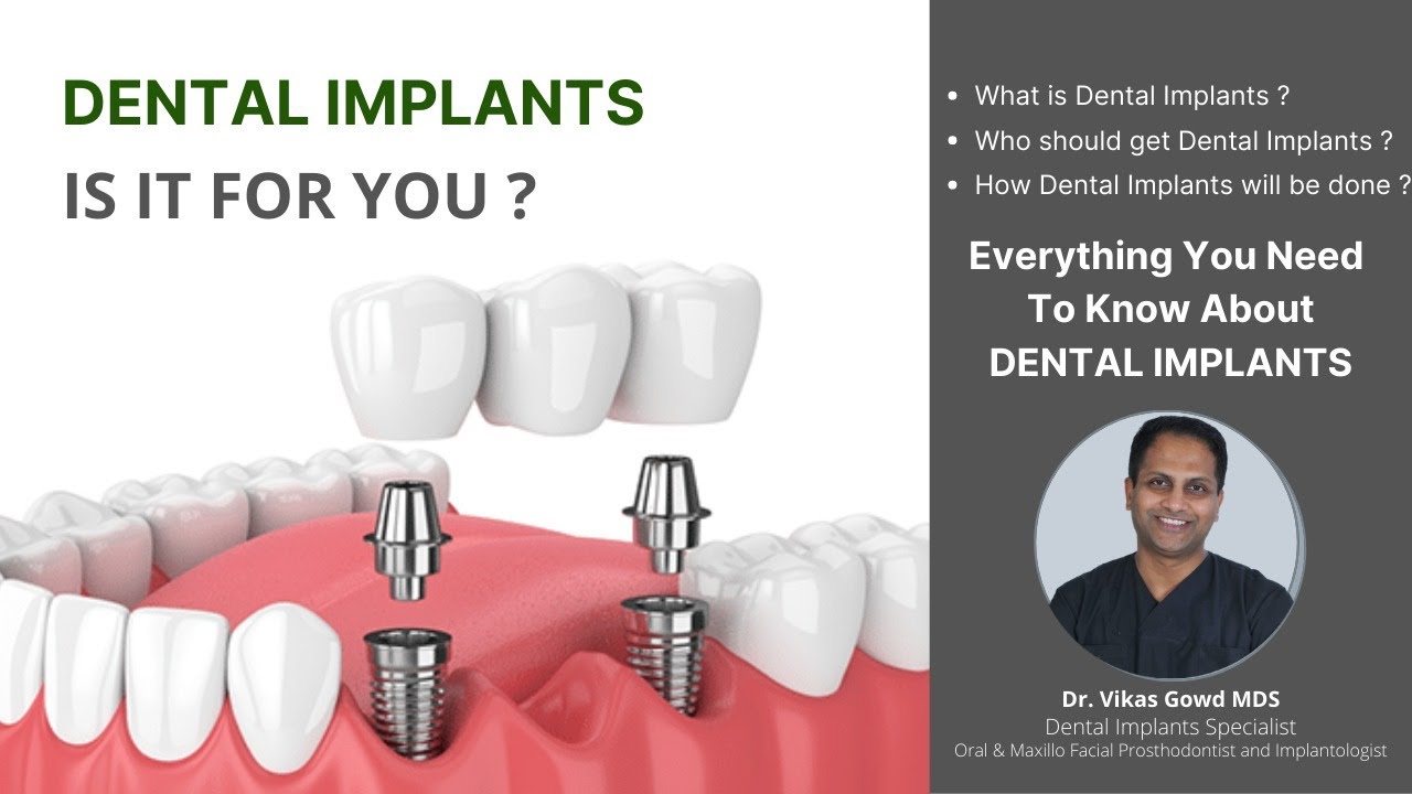 Dental implant in Hyderabad Best Dental implant in Hyderabad [Dr