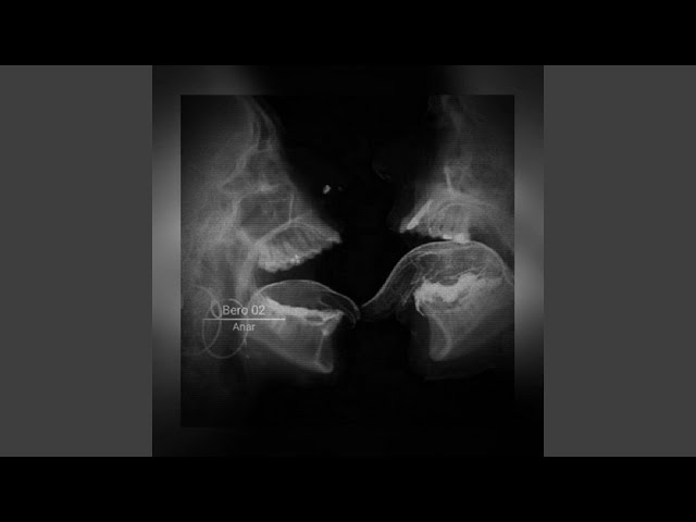 BERO 02 - Ultra Slowed